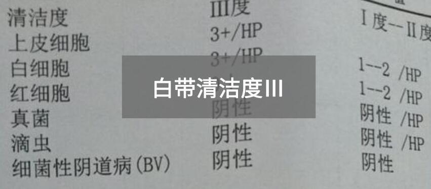 今天快讯！全自动白带午夜小视频网站生产厂家午夜福利网址小视频为您官方解释白带清洁度3的意思